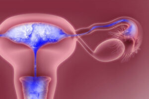 m/قیمت عکس رنگی رحم